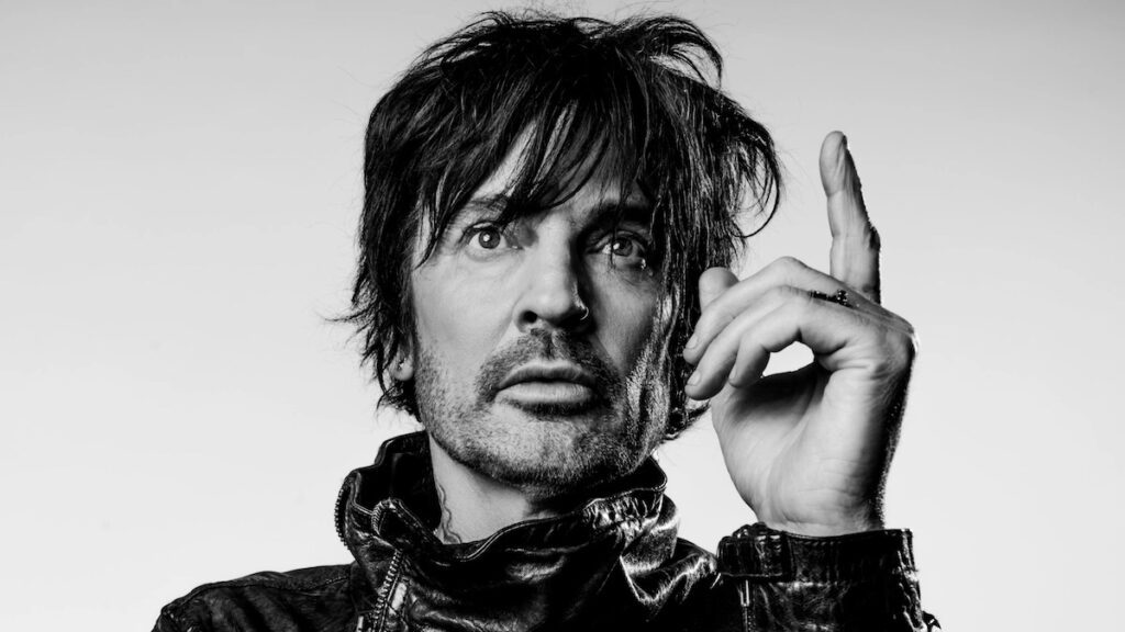 Tommy Lee Undergoes Gruesome Hand Surgery: “i Have My Life