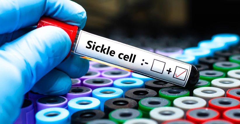 Black 12 Year Old Patient Begins New Sickle Cell Therapy