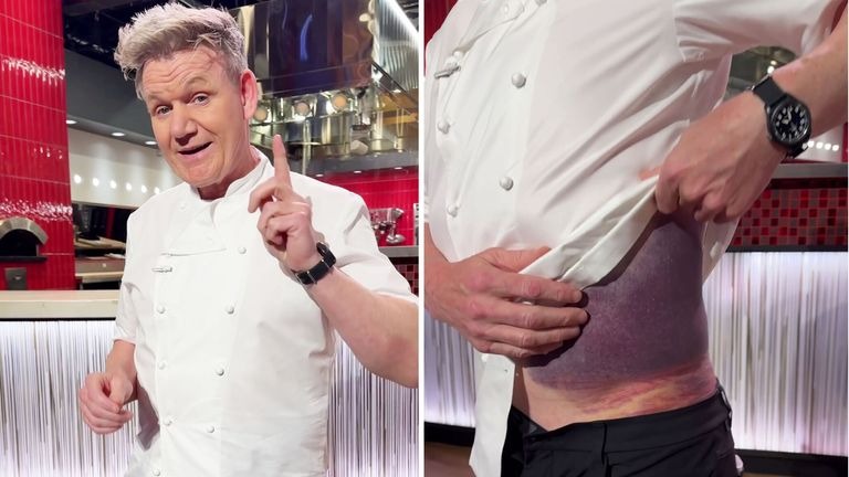 Gordon Ramsay Is “lucky To Be Here” After Bad Bicycle