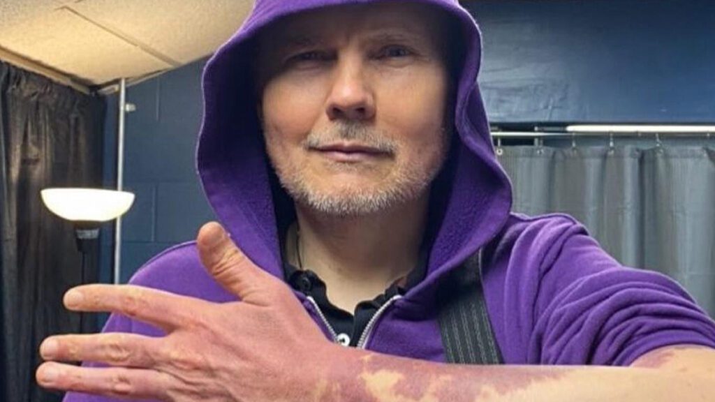 Billy Corgan Shows Off Port Wine Birthmarks In Body Positivity Statement