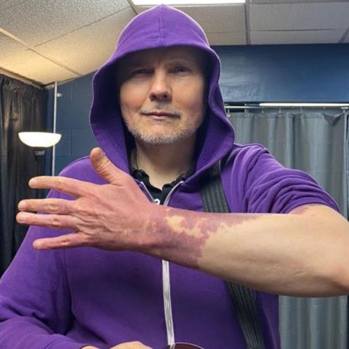 Billy Corgan Finally Embracing Port Wine Birthmarks He Tried To Hide