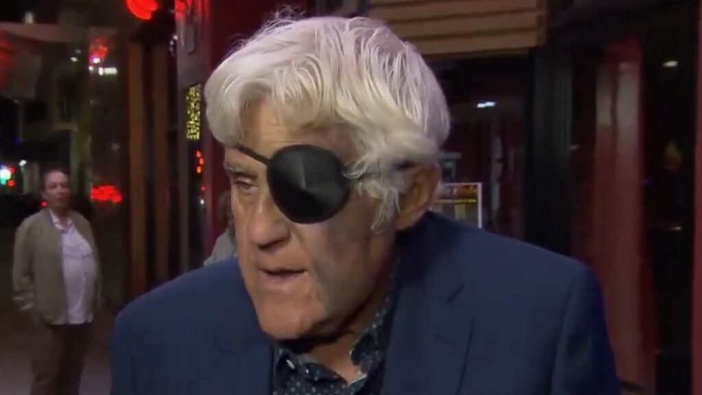 Jay Leno Is “all Black And Blue” After Falling 60